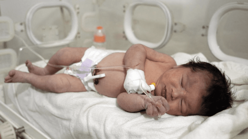 Milagro: rescataron a una bebé que nació bajo los escombros en Siria